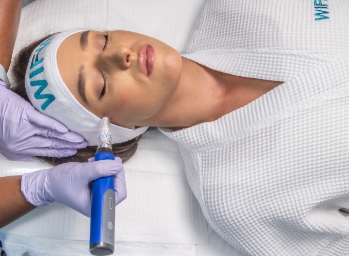 SkinPen Microneedling Atlanta