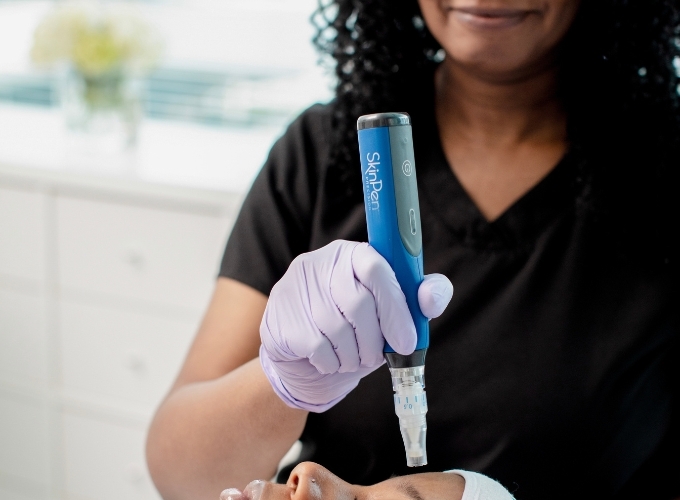 How Does Microneedling Work