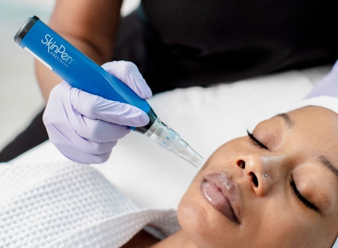 Microneedling risks and side effects
