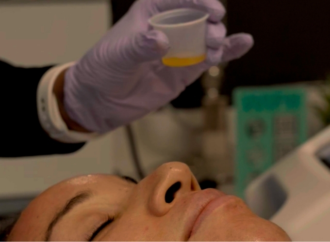 Skinpen Microneedling PureGF/PRP add-on