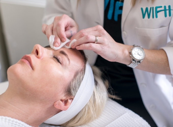 What to expect during microneedling