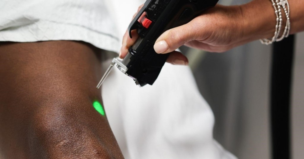 Laser hair removal for dark skin from WIFH in Atlanta