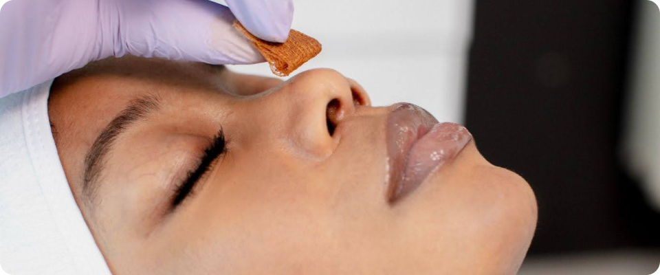 A detailed shot of a patient receiving a chemical peel application to treat facial hyperpigmentation
