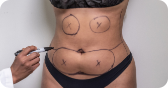 What to Expert Image