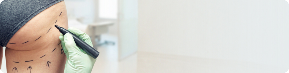 What to Expert Image