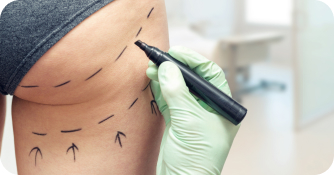 What to Expert Image