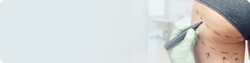 What to Expert Image