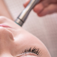 Microdermabrasion FAQs