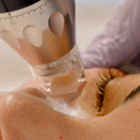 RF Microneedling FAQs