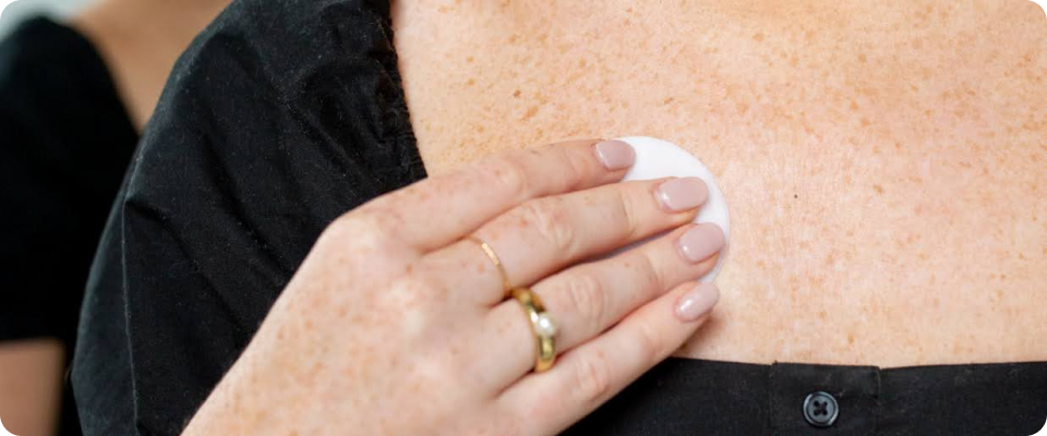 A close-up shot of a person applying treatment serum to sun-damaged skin on the upper chest