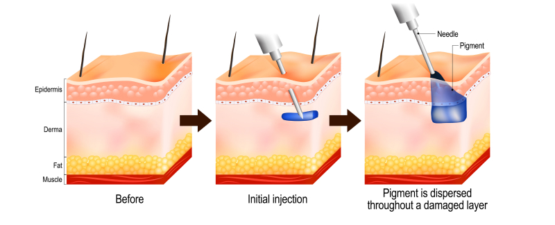 introduction Image