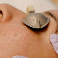 CoolPeel FAQs
