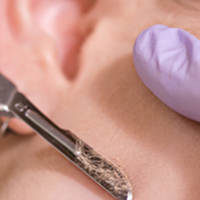 Dermaplaning FAQs