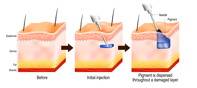 introduction Image