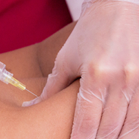 Sculptra BBL FAQs