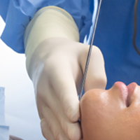 Smartlipo FAQs