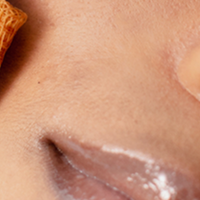 VI Peel FAQs