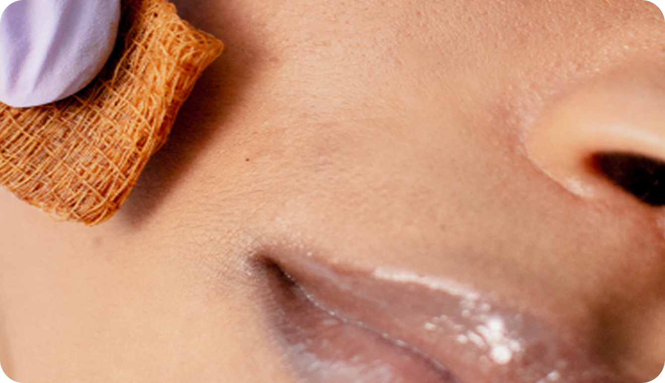 Chemical Peels