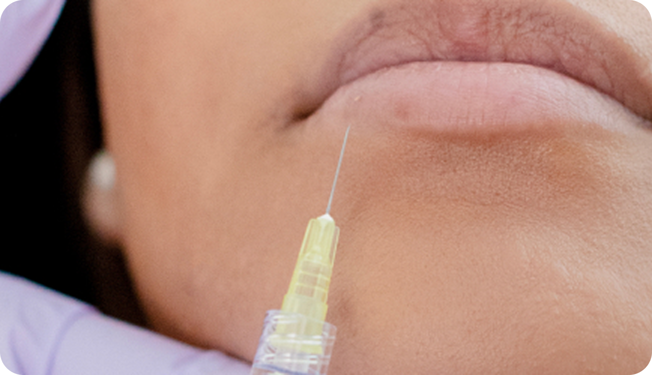 Neurotoxin Injectables & Fillers