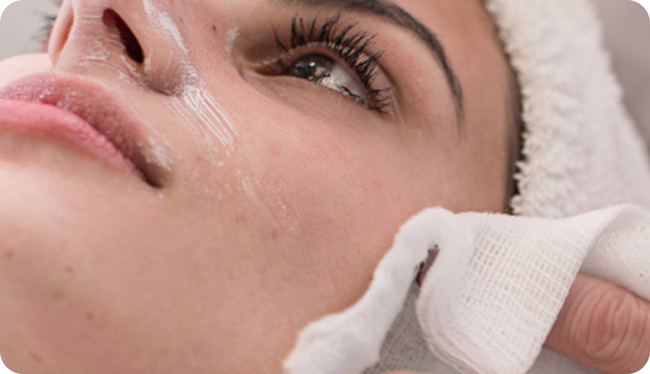 Skin Resurfacing Treatments